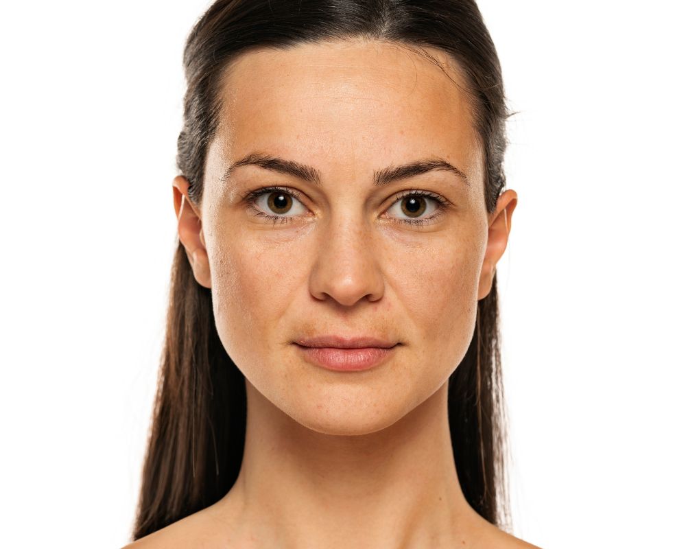 Wie entstehen Pigmentflecken und was kann ich dagegen tun?